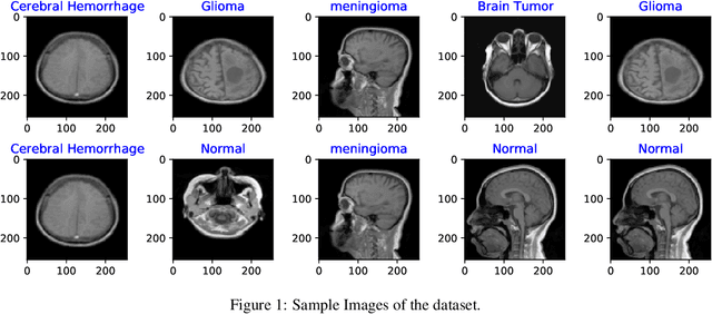Figure 1 for An Exploratory Approach Towards Investigating and Explaining Vision Transformer and Transfer Learning for Brain Disease Detection