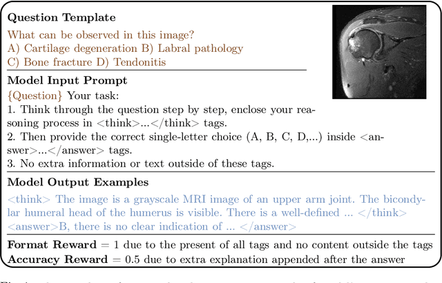 Figure 1 for MedVLM-R1: Incentivizing Medical Reasoning Capability of Vision-Language Models (VLMs) via Reinforcement Learning