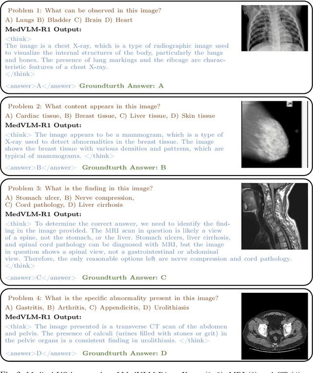 Figure 3 for MedVLM-R1: Incentivizing Medical Reasoning Capability of Vision-Language Models (VLMs) via Reinforcement Learning
