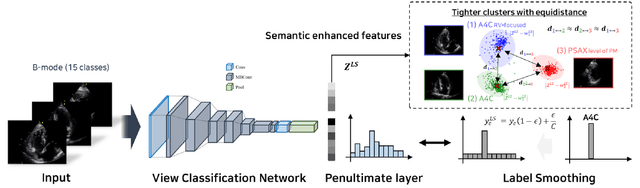 Figure 3 for Echocardiographic View Classification with Integrated Out-of-Distribution Detection for Enhanced Automatic Echocardiographic Analysis