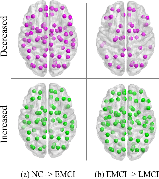 Figure 4 for Fusing Structural and Functional Connectivities using Disentangled VAE for Detecting MCI
