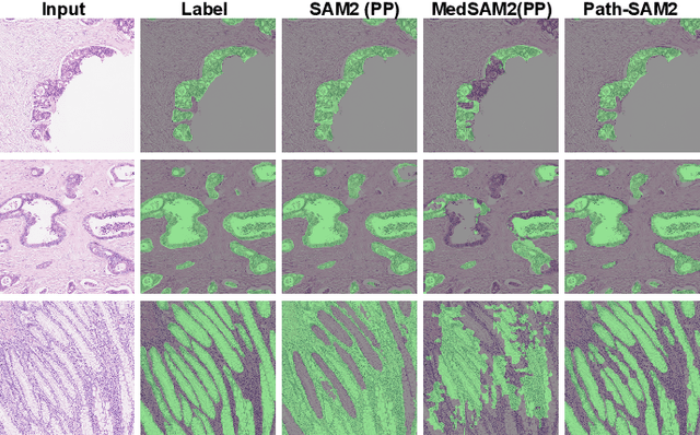 Figure 3 for SAM2-PATH: A better segment anything model for semantic segmentation in digital pathology