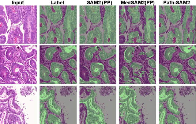 Figure 4 for SAM2-PATH: A better segment anything model for semantic segmentation in digital pathology