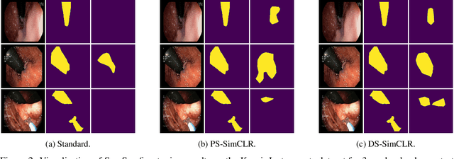 Figure 4 for DeepSet SimCLR: Self-supervised deep sets for improved pathology representation learning