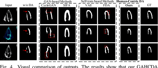 Figure 4 for Gaze-Assisted Human-Centric Domain Adaptation for Cardiac Ultrasound Image Segmentation