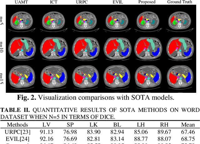 Figure 3 for Alleviating Class Imbalance in Semi-supervised Multi-organ Segmentation via Balanced Subclass Regularization