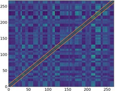 Figure 3 for VITS2: Improving Quality and Efficiency of Single-Stage Text-to-Speech with Adversarial Learning and Architecture Design