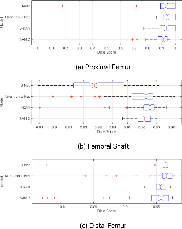 Figure 2 for Performance Analysis of Deep Learning Models for Femur Segmentation in MRI Scan