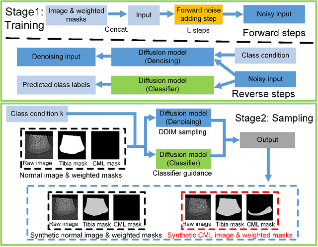 Figure 1 for Masked Conditional Diffusion Models for Image Analysis with Application to Radiographic Diagnosis of Infant Abuse