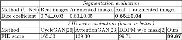 Figure 4 for Masked Conditional Diffusion Models for Image Analysis with Application to Radiographic Diagnosis of Infant Abuse
