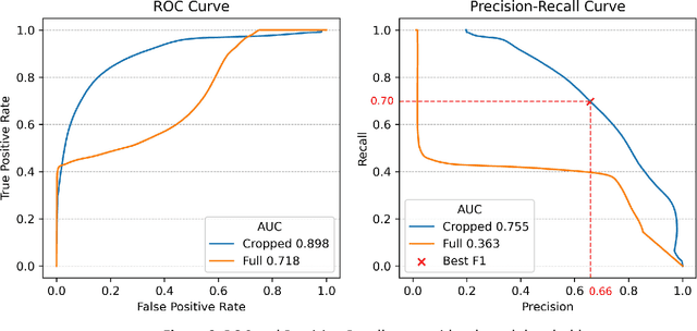 Figure 4 for Automatic segmentation of colorectal liver metastases for ultrasound-based navigated resection