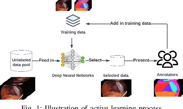 Figure 1 for Parsimonious Dataset Construction for Laparoscopic Cholecystectomy Structure Segmentation