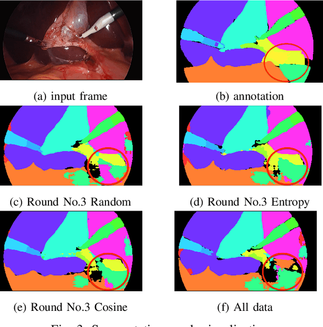Figure 3 for Parsimonious Dataset Construction for Laparoscopic Cholecystectomy Structure Segmentation