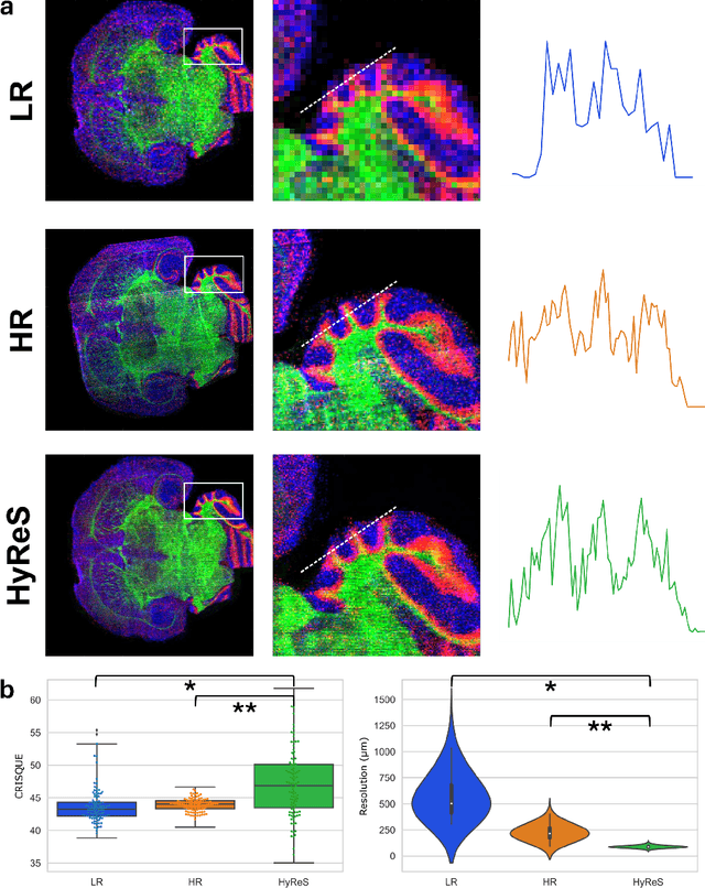 Figure 4 for Hyperspectral Image Restoration and Super-resolution with Physics-Aware Deep Learning for Biomedical Applications