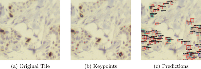 Figure 1 for PathRTM: Real-time prediction of KI-67 and tumor-infiltrated lymphocytes