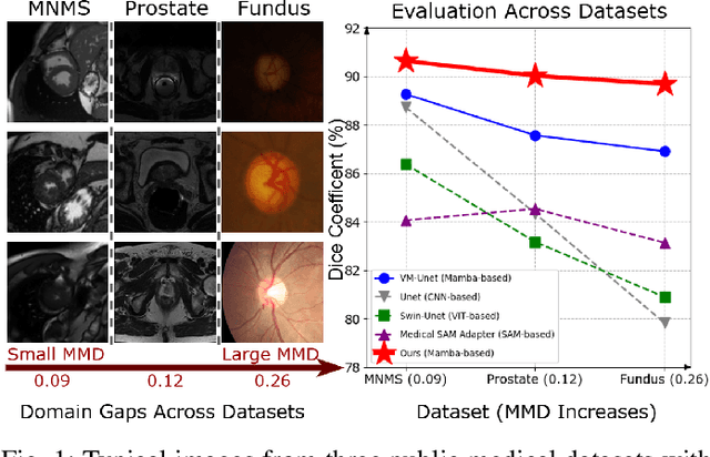 Figure 1 for Mamba-Sea: A Mamba-based Framework with Global-to-Local Sequence Augmentation for Generalizable Medical Image Segmentation