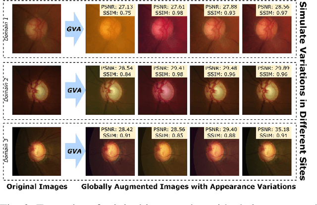 Figure 3 for Mamba-Sea: A Mamba-based Framework with Global-to-Local Sequence Augmentation for Generalizable Medical Image Segmentation