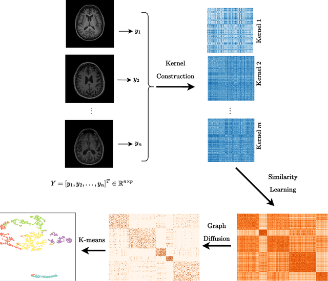 Figure 1 for Clustering Alzheimer's Disease Subtypes via Similarity Learning and Graph Diffusion