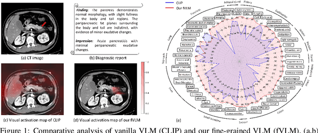 Figure 1 for Large-scale and Fine-grained Vision-language Pre-training for Enhanced CT Image Understanding