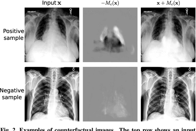 Figure 3 for Attri-Net: A Globally and Locally Inherently Interpretable Model for Multi-Label Classification Using Class-Specific Counterfactuals