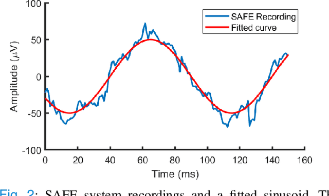 Figure 2 for Sub-Scalp Brain-Computer Interface Device Design and Fabrication
