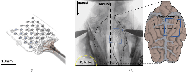 Figure 3 for Sub-Scalp Brain-Computer Interface Device Design and Fabrication