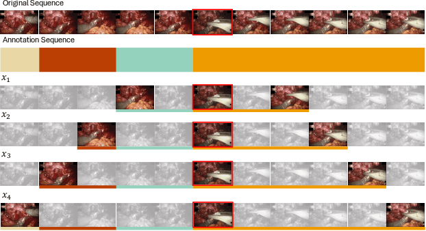Figure 3 for MuST: Multi-Scale Transformers for Surgical Phase Recognition