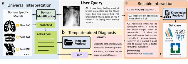 Figure 1 for ChatCAD+: Towards a Universal and Reliable Interactive CAD using LLMs