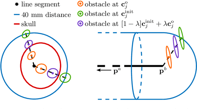 Figure 4 for Path Planning for Concentric Tube Robots: a Toolchain with Application to Stereotactic Neurosurgery