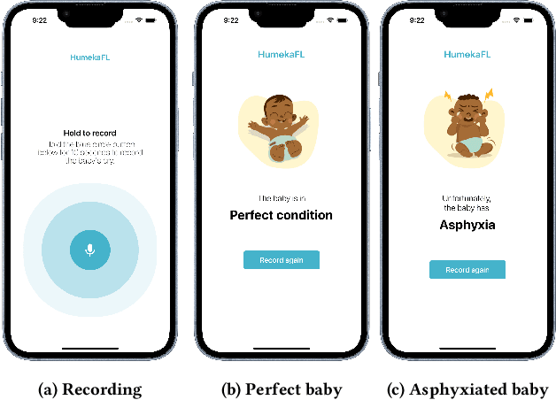 Figure 4 for HumekaFL: Automated Detection of Neonatal Asphyxia Using Federated Learning