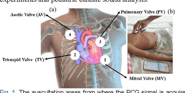 Figure 1 for Classification of Short Segment Pediatric Heart Sounds Based on a Transformer-Based Convolutional Neural Network