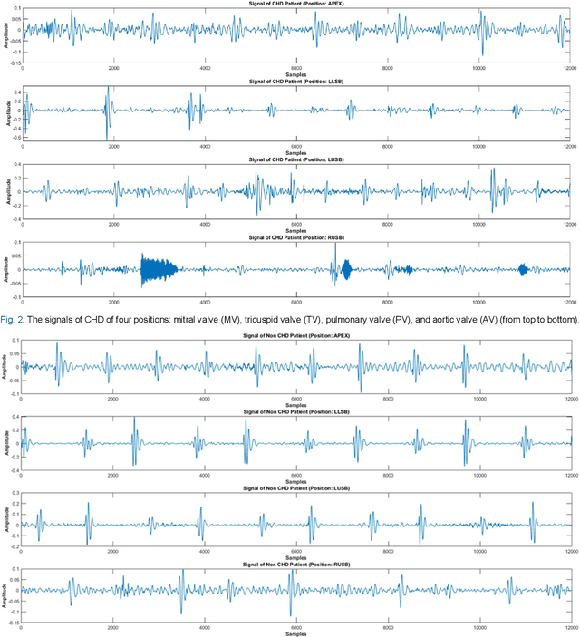 Figure 4 for Classification of Short Segment Pediatric Heart Sounds Based on a Transformer-Based Convolutional Neural Network