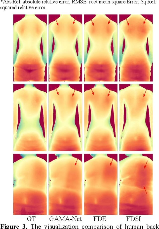 Figure 4 for A Dual-Feature Extractor Framework for Accurate Back Depth and Spine Morphology Estimation from Monocular RGB Images