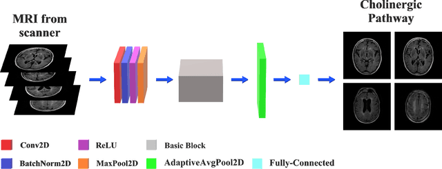Figure 1 for Using ResNet to Utilize 4-class T2-FLAIR Slice Classification Based on the Cholinergic Pathways Hyperintensities Scale for Pathological Aging