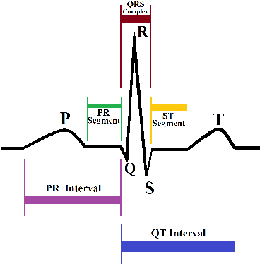 Figure 3 for Dense Neural Network Based Arrhythmia Classification on Low-cost and Low-compute Micro-controller