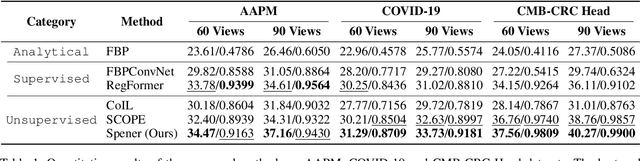 Figure 2 for Unsupervised Self-Prior Embedding Neural Representation for Iterative Sparse-View CT Reconstruction