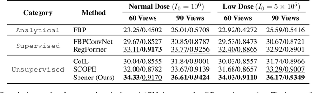 Figure 4 for Unsupervised Self-Prior Embedding Neural Representation for Iterative Sparse-View CT Reconstruction