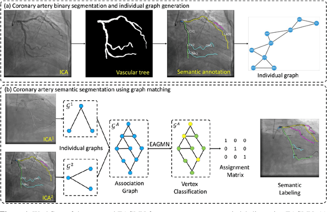 Figure 1 for Coronary Artery Semantic Labeling using Edge Attention Graph Matching Network