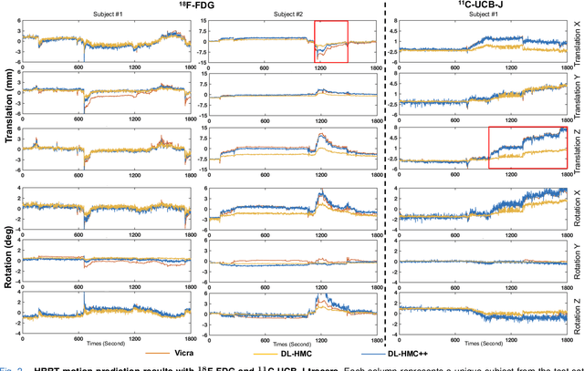 Figure 2 for PET Head Motion Estimation Using Supervised Deep Learning with Attention