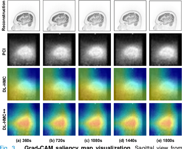 Figure 3 for PET Head Motion Estimation Using Supervised Deep Learning with Attention