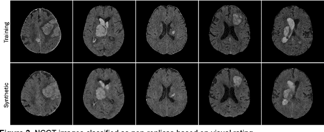 Figure 4 for RELICT: A Replica Detection Framework for Medical Image Generation
