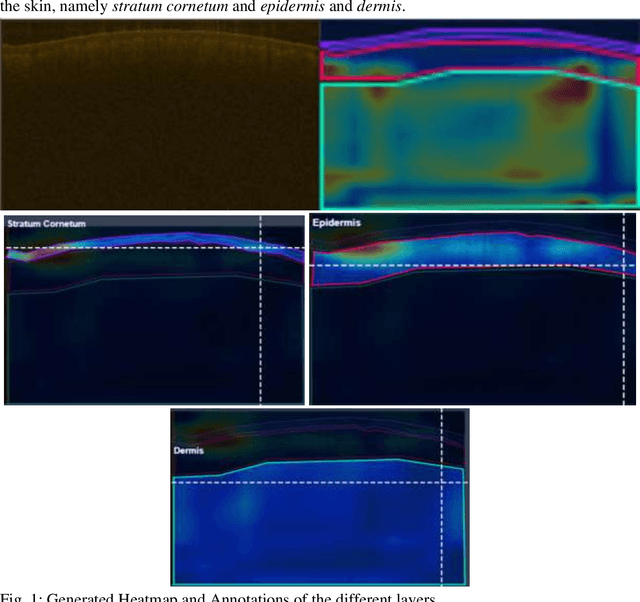 Figure 1 for Deep Learning-Driven Heat Map Analysis for Evaluating thickness of Wounded Skin Layers