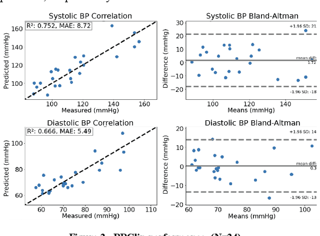 Figure 2 for Development of a One Dollar Blood Pressure Monitor