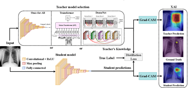 Figure 1 for Explainable Knowledge Distillation for On-device Chest X-Ray Classification