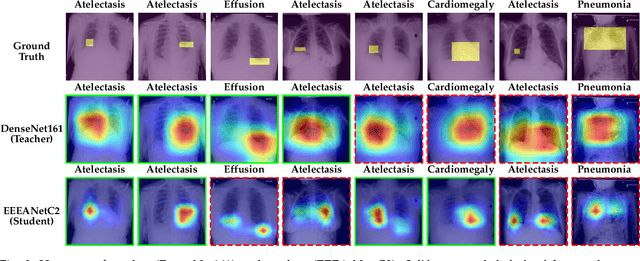 Figure 4 for Explainable Knowledge Distillation for On-device Chest X-Ray Classification