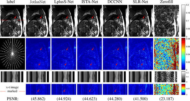 Figure 3 for JotlasNet: Joint Tensor Low-Rank and Attention-based Sparse Unrolling Network for Accelerating Dynamic MRI