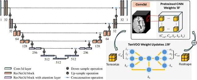Figure 1 for Parameter-Efficient Fine-Tuning of 3D DDPM for MRI Image Generation Using Tensor Networks