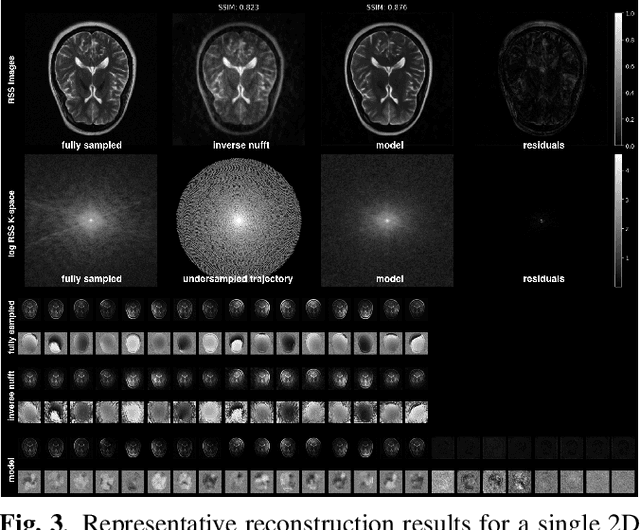 Figure 3 for Learning the Domain Specific Inverse NUFFT for Accelerated Spiral MRI using Diffusion Models