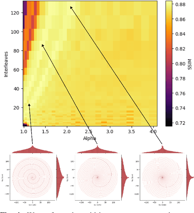 Figure 4 for Learning the Domain Specific Inverse NUFFT for Accelerated Spiral MRI using Diffusion Models