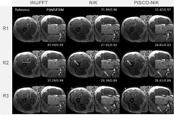 Figure 3 for Self-Supervised k-Space Regularization for Motion-Resolved Abdominal MRI Using Neural Implicit k-Space Representation